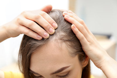 a woman with a hair loss problem